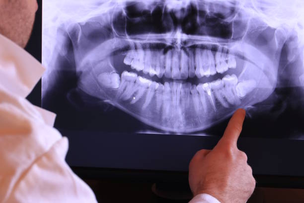 Best Tooth Infection Emergency Dentist  in Boalsburg, PA