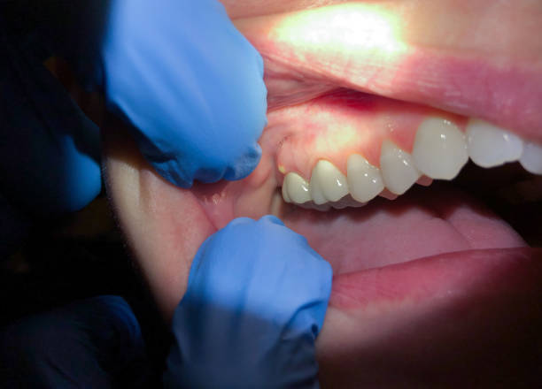 Best Emergency Gum Pain Relief  in Boalsburg, PA
